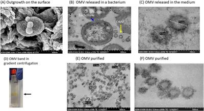 Stannous fluoride protects gingival keratinocytes against infection and oxidative stress by Porphyromonas gingivalis outer membrane vesicles